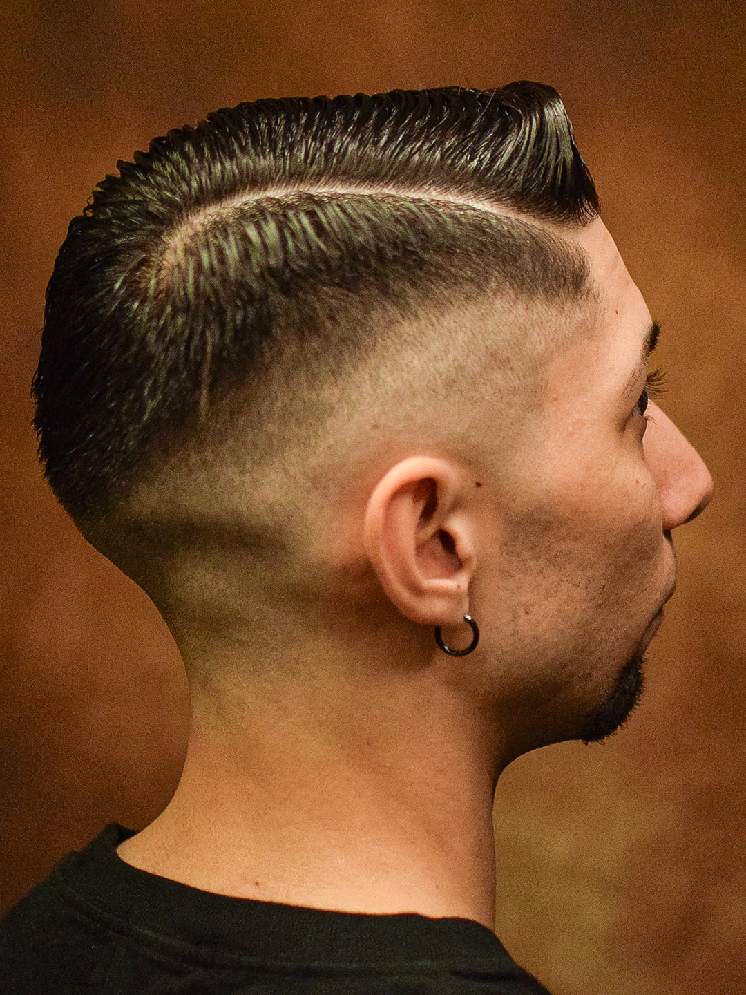 FADEで整える頭骨の凹み補正